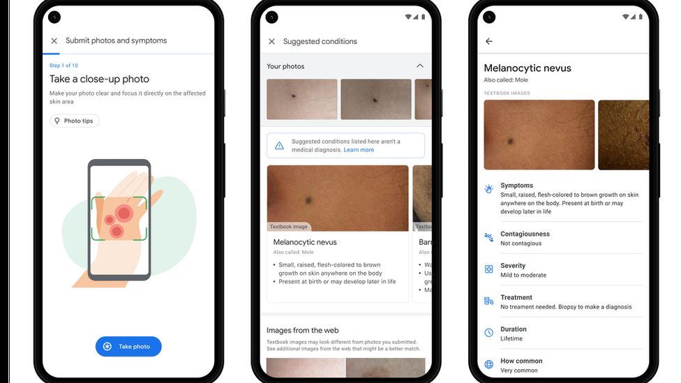 Инструмент Google AI может помочь пациентам идентифицировать кожные заболевания 1 Google AI