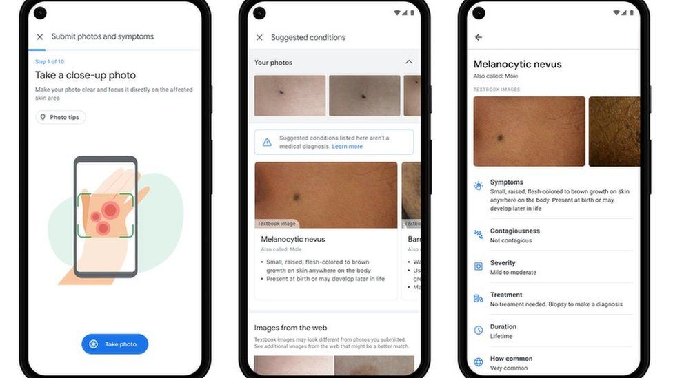 Шесть анонсов от Google I/O 6 118565324 02 derm steps