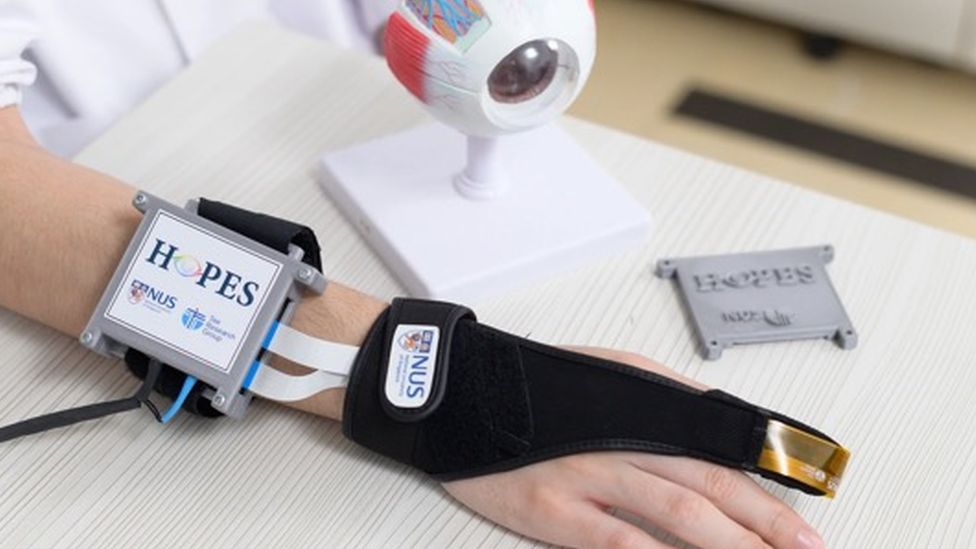 Image caption, The device consists of a glove, a sensor and a mobile app