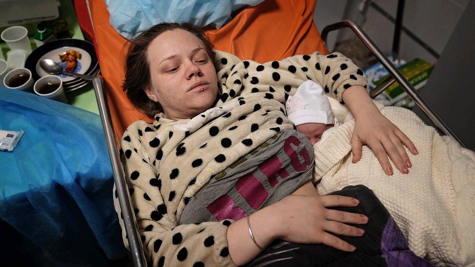 Марианна Вышемирская в другой больнице после родов дочери, через несколько дней после бомбардировки