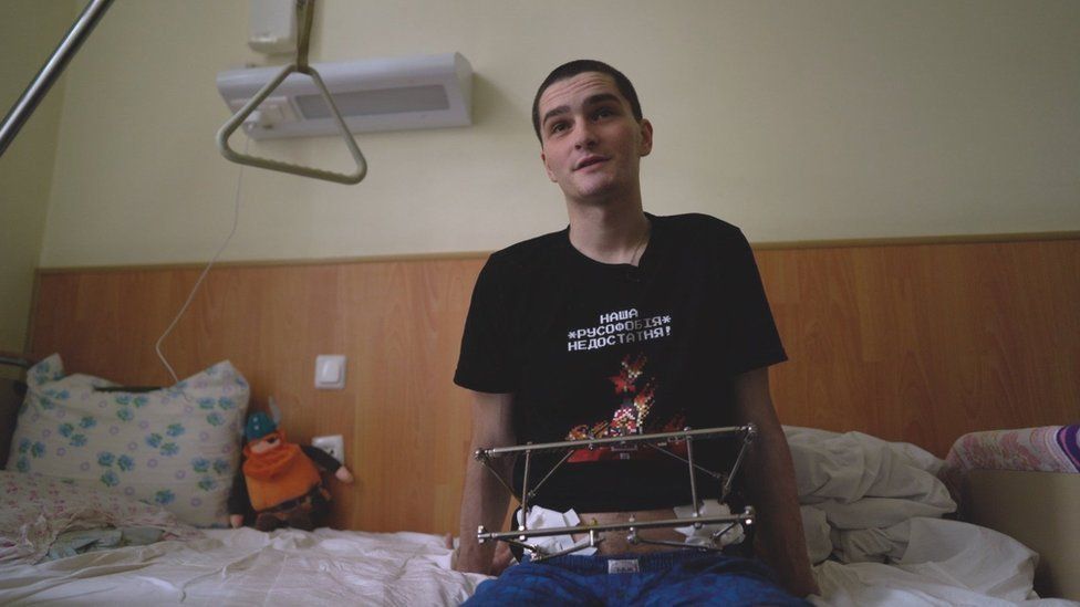 , Hlib Stryzhko suffered a broken pelvis and jaw when he came under attack from a Russian tank