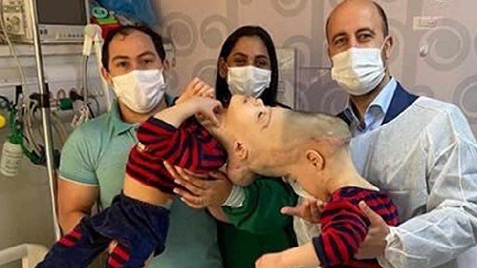 Бернардо и Артур Лима с родителями и хирургом