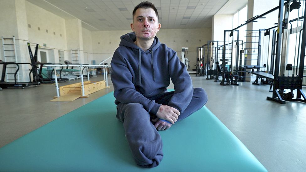 Illya Pylypenko was badly wounded when his tank rolled over a mine in southern Ukraine