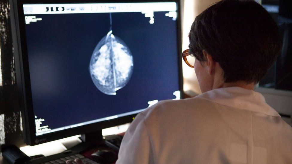 Radiologist looks at mammogram results on a computer