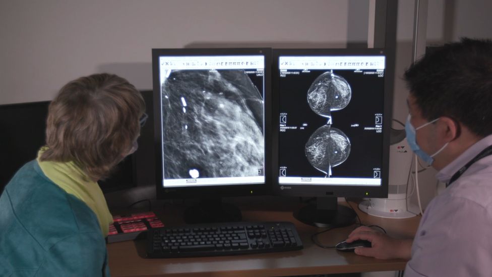 Dr Lip talks June through the changes the AI software detected in her mammogram